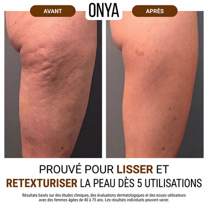 ONYA™ Huile Effet Soie